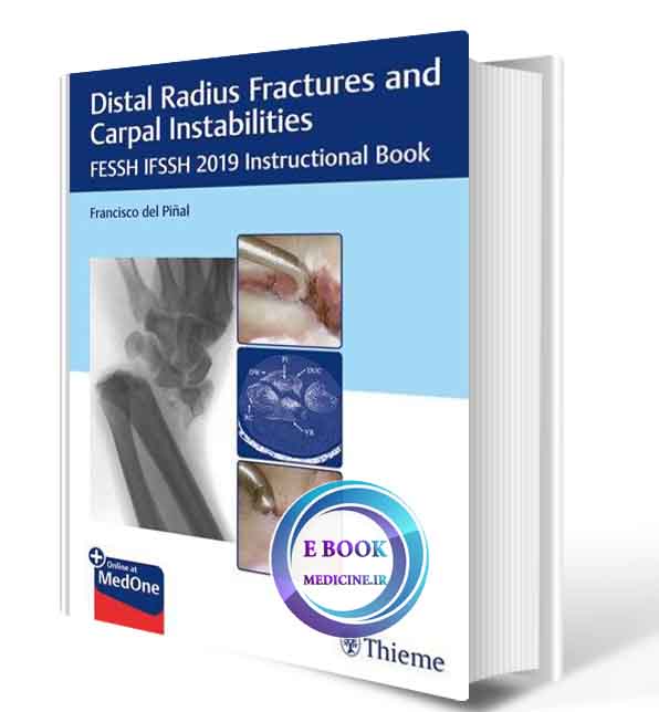 دانلود کتابDistal Radius Fractures and Carpal Instabilities: FESSH IFSSH 2019 Instructional Book 1st 2019 (PDF)